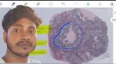 Human Reproduction | NEET 2025 Biology | Complete Chapter in One Shot