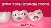 When your wisdom tooth comes in