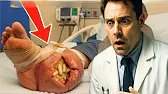 🫢 MAN IGNORES FOOT PAIN, BUT WHEN HE GOES TO THE HOSPITAL, HE LEAVES THE DOCTOR IN SHOCK