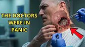 Man Scratches His Neck for Days — WHEN HE ARRIVES AT THE HOSPITAL, NURSES SCREAM IN SHOCK