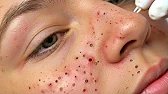 Skincare Routine to Reduce Skin Stress Sac Dep Spa