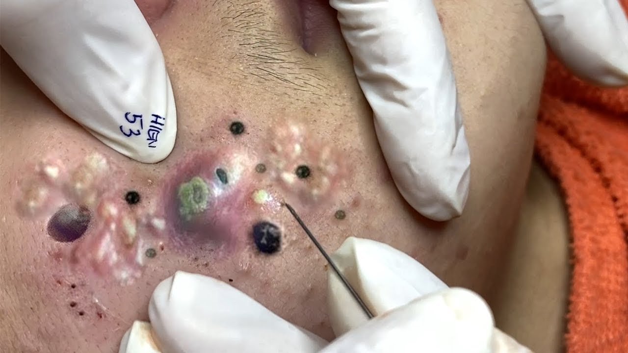 𝑺𝒐𝒐𝒕𝒉𝒊𝒏𝒈 𝑭𝒂𝒄𝒊𝒂𝒍 𝑻𝒓𝒆𝒂𝒕𝒎𝒆𝒏𝒕 𝒇𝒐𝒓 𝑺𝒕𝒓𝒆𝒔𝒔 𝑹𝒆𝒍𝒊𝒆𝒇 | 𝑫𝒆𝒆𝒑 𝑪𝒍𝒆𝒂𝒏𝒊𝒏𝒈 & 𝑪𝒂𝒍𝒎𝒊𝒏𝒈 𝑴𝒂𝒔𝒔𝒂𝒈𝒆 𝒂𝒕 𝑳𝒖𝒙𝒖𝒓𝒚 𝑺𝒑𝒂 #886792