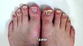 Underlying Causes of Rough Feet and Legs