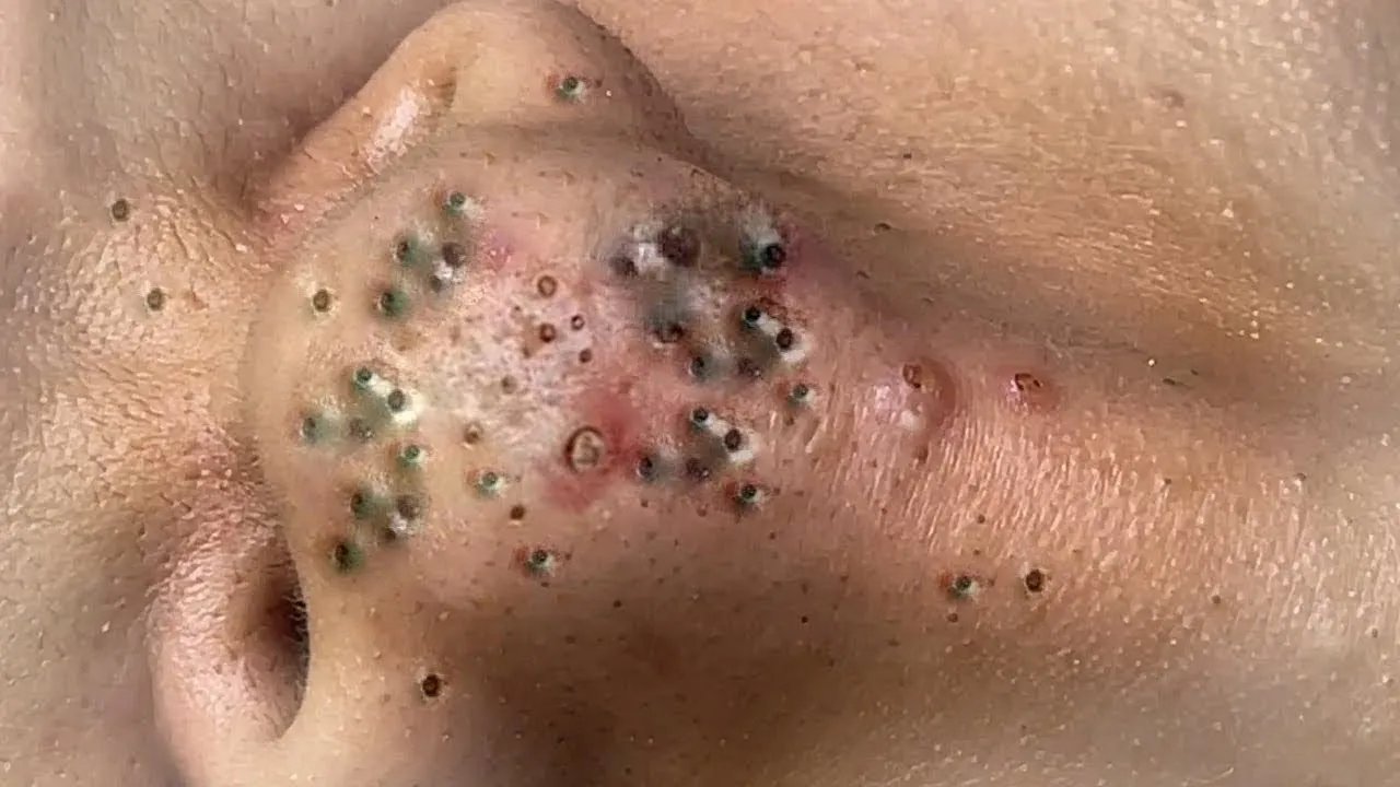 𝑺𝒐𝒐𝒕𝒉𝒊𝒏𝒈 𝑭𝒂𝒄𝒊𝒂𝒍 𝑻𝒓𝒆𝒂𝒕𝒎𝒆𝒏𝒕 𝒇𝒐𝒓 𝑺𝒕𝒓𝒆𝒔𝒔 𝑹𝒆𝒍𝒊𝒆𝒇 | 𝑫𝒆𝒆𝒑 𝑪𝒍𝒆𝒂𝒏𝒊𝒏𝒈 & 𝑪𝒂𝒍𝒎𝒊𝒏𝒈 𝑴𝒂𝒔𝒔𝒂𝒈𝒆 𝒂𝒕 𝑳𝒖𝒙𝒖𝒓𝒚 𝑺𝒑𝒂 #88619