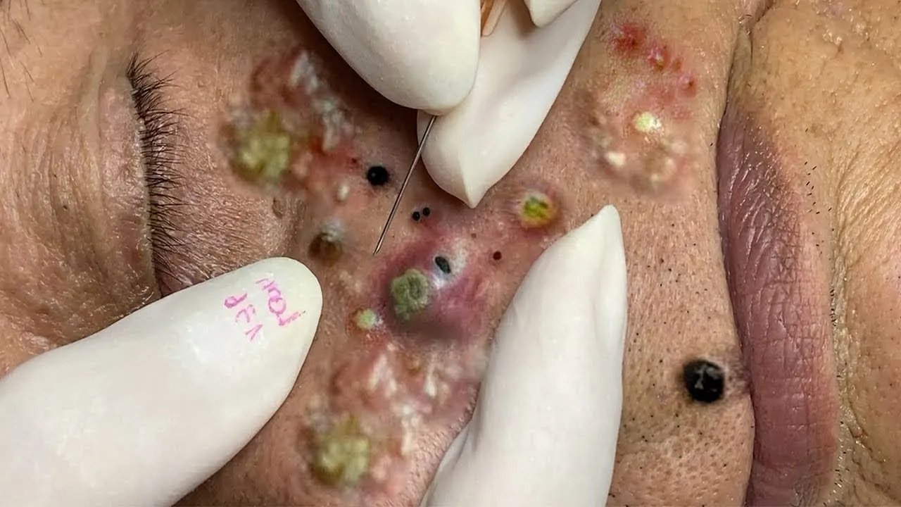 𝑺𝒐𝒐𝒕𝒉𝒊𝒏𝒈 𝑭𝒂𝒄𝒊𝒂𝒍 𝑻𝒓𝒆𝒂𝒕𝒎𝒆𝒏𝒕 𝒇𝒐𝒓 𝑺𝒕𝒓𝒆𝒔𝒔 𝑹𝒆𝒍𝒊𝒆𝒇 | 𝑫𝒆𝒆𝒑 𝑪𝒍𝒆𝒂𝒏𝒊𝒏𝒈 & 𝑪𝒂𝒍𝒎𝒊𝒏𝒈 𝑴𝒂𝒔𝒔𝒂𝒈𝒆 𝒂𝒕 𝑳𝒖𝒙𝒖𝒓𝒚 𝑺𝒑𝒂 #𝟓𝟕𝟒𝟐