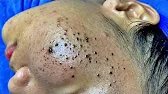 How to Prevent Skin Irritation While Cleansing Sac Dep Spa