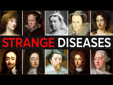 25 British Royals Who Died Of STRANGEST DISEASES | For Sleep