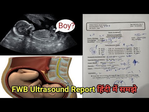 Variable Presentation क्या होता है | FWB Ultrasound Report padhna sikhe | Pregnancy Report 19 Weeks
