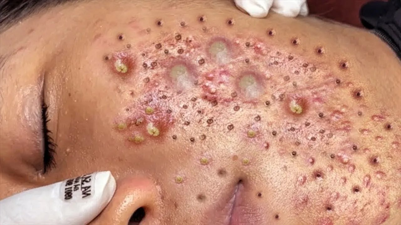 𝑺𝒐𝒐𝒕𝒉𝒊𝒏𝒈 𝑭𝒂𝒄𝒊𝒂𝒍 𝑻𝒓𝒆𝒂𝒕𝒎𝒆𝒏𝒕 𝒇𝒐𝒓 𝑺𝒕𝒓𝒆𝒔𝒔 𝑹𝒆𝒍𝒊𝒆𝒇 | 𝑫𝒆𝒆𝒑 𝑪𝒍𝒆𝒂𝒏𝒊𝒏𝒈 & 𝑪𝒂𝒍𝒎𝒊𝒏𝒈 𝑴𝒂𝒔𝒔𝒂𝒈𝒆 𝒂𝒕 𝑳𝒖𝒙𝒖𝒓𝒚 𝑺𝒑𝒂 #88614