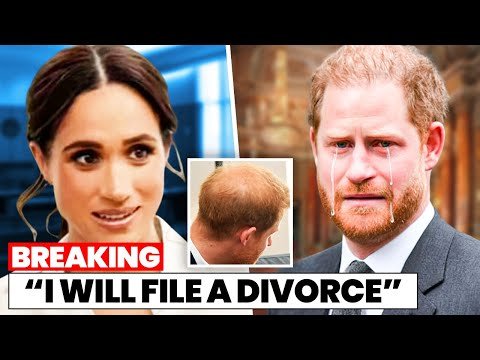 HARRY LOSES IT When His Hairline Becomes the ...